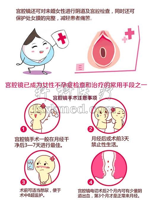 宫腔镜1.jpg