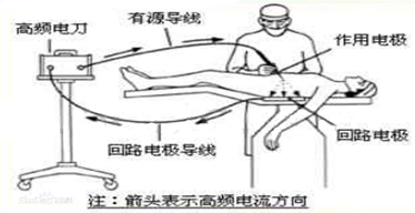 有源器械和无源器械是什么？解释来了，给我码住！